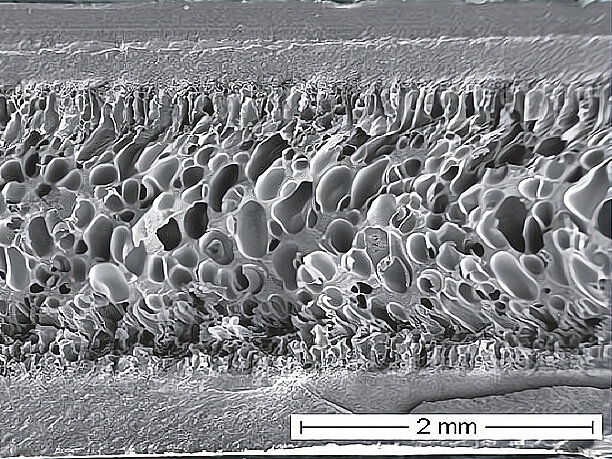 NMB_TSG_morphologie