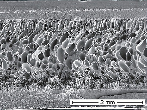 NMB_TSG_morphologie